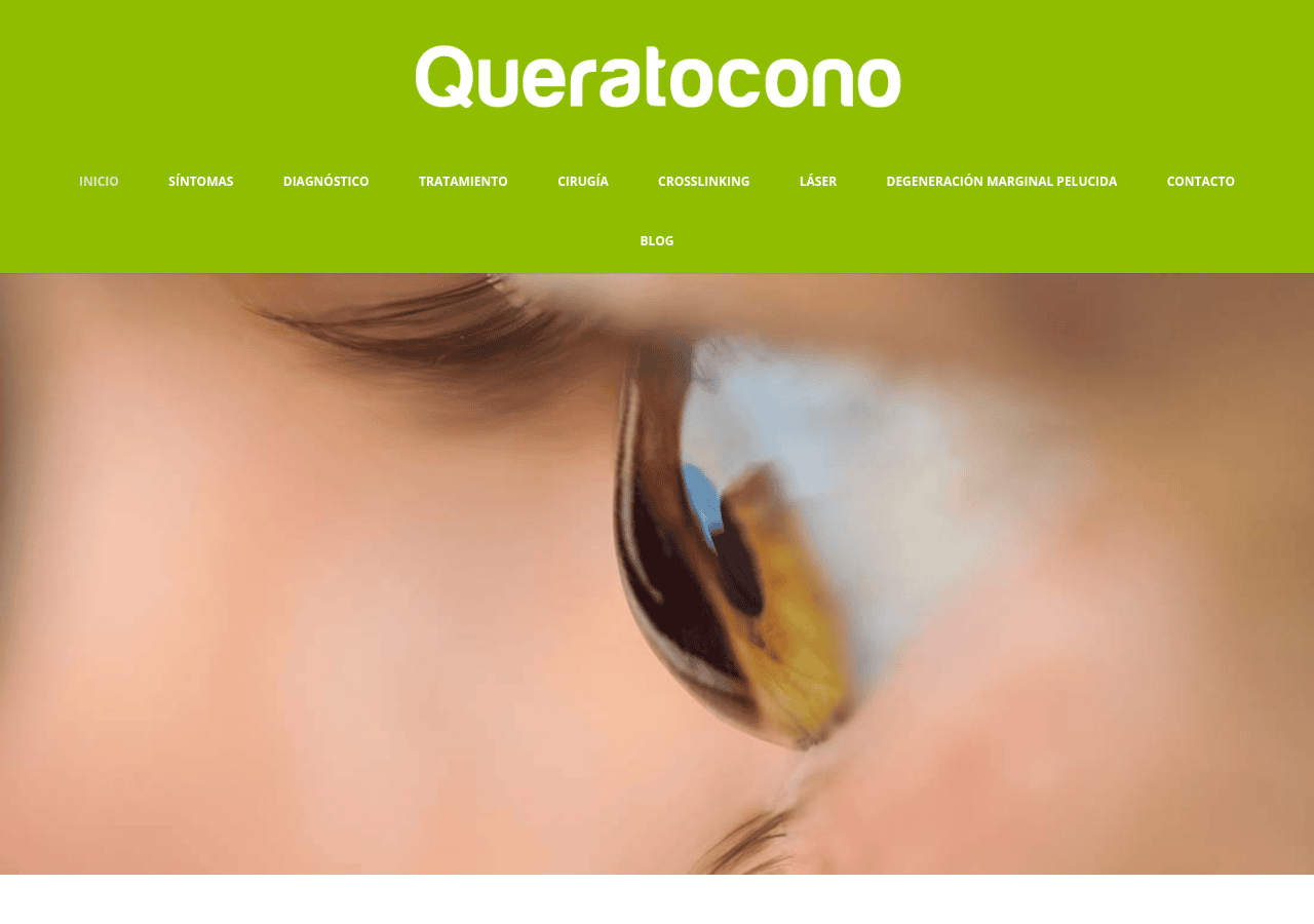 Screenshot of queratocono.es