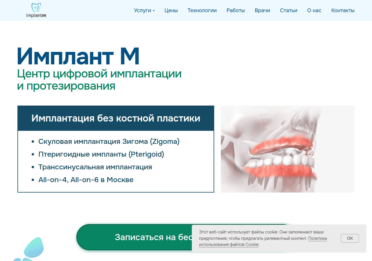 Screenshot of implantm.ru